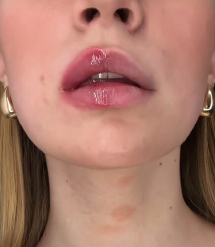 Powiększacz do ust Lip Plumper photo review