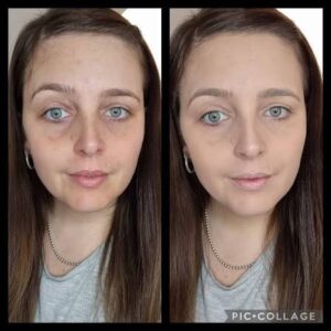 Powiększacz do ust Lip Plumper photo review